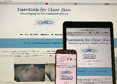Acne Skin Care Website by Sims Solutions